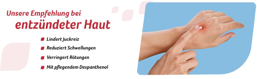 Fenistil